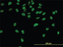 Anti-CPSF3 Mouse Monoclonal Antibody [clone: 6E6]