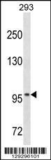 Anti-OTUD7A Rabbit Polyclonal Antibody (AP (Alkaline Phosphatase))