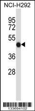 Anti-FCGR2A Rabbit Polyclonal Antibody (FITC (Fluorescein Isothiocyanate))