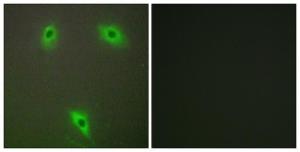 Anti-KLHL3 antibody