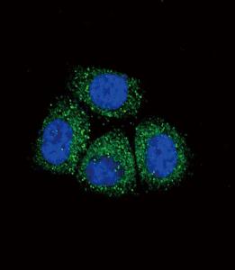 Anti-SCNN1A Rabbit Polyclonal Antibody (AP (Alkaline Phosphatase))