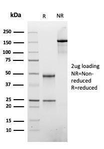 Anti-ATRX Mouse Recombinant Antibody [clone: rATRX/3446]