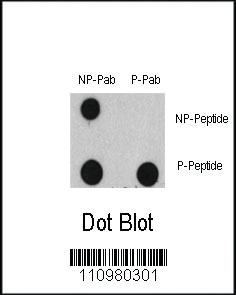 Anti-EGFR Rabbit Polyclonal Antibody