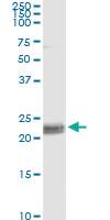 Anti-CD8A Mouse Monoclonal Antibody [clone: 4B9]