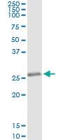 Anti-KCNIP3 Mouse Monoclonal Antibody [clone: 2B3-A1]