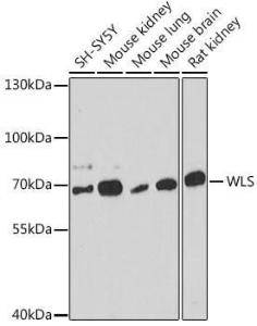 Western blot analysis of extracts of various cell lines, using Anti-GPR177/WLS Antibody (A309235) at 1:1000 dilution. The secondary Antibody was Goat Anti-Rabbit IgG H&L Antibody (HRP) at 1:10000 dilution. Lysates/proteins were present at 25 µg per lane