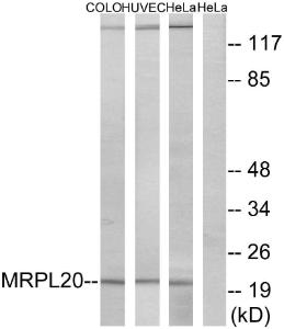 Anti-MRPL20 Rabbit Polyclonal Antibody