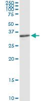 Anti-APEX1 Rabbit Polyclonal Antibody