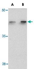 Anti-C1QTNF6 Rabbit Polyclonal Antibody