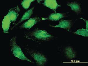 Anti-SSR2 Mouse Monoclonal Antibody [clone: 4C1]