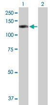 Anti-OSBPL8 Mouse Polyclonal Antibody