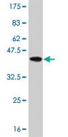 Anti-BRAF Mouse Monoclonal Antibody [clone: 2E9]