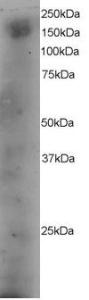 Anti-DOCK1 Antibody (A83785) staining (4µg/ml) of A431 lysate (RIPA buffer, 35µg total protein per lane). Primary incubated for 12 hour. Detected by western blot using chemiluminescence.