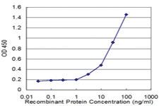 Anti-CD8A Mouse Monoclonal Antibody [clone: 4B9]