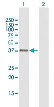 Anti-APEX1 Rabbit Polyclonal Antibody