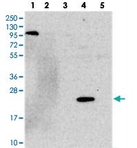 Anti-OLAH Rabbit Polyclonal Antibody