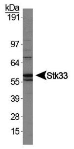 Anti-HIST3H3 Rabbit Polyclonal Antibody (HRP (Horseradish Peroxidase))