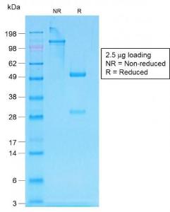 SDS-PAGE analysis of Anti-Human IgG Heavy Chain Antibody [IG507R] under non-reduced and reduced conditions; showing intact IgG and intact heavy and light chains, respectively. SDS-PAGE analysis confirms the integrity and purity of the antibody