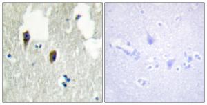 Anti-KLHL3 antibody