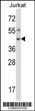 Anti-NIM1K Rabbit Polyclonal Antibody (HRP (Horseradish Peroxidase))