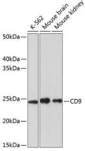 Western blot analysis of extracts of various cell lines, using Anti-CD9 Antibody [ARC0330] (A309237) at 1:1000 dilution. The secondary Antibody was Goat Anti-Rabbit IgG H&L Antibody (HRP) at 1:10000 dilution. Lysates/proteins were present at 25 µg per lane