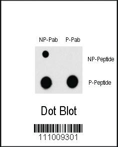 Anti-MEF2C Rabbit Polyclonal Antibody