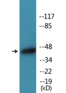 Western blot analysis of lysates from HeLa cells treated with TNF 20ng/ml 5' + calyculin A 50ng/ml 5' using Anti-Caspase 9 (phospho Thr125) Antibody