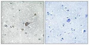 Anti-MRPL20 Rabbit Polyclonal Antibody