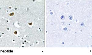 Anti-HMGN2 Rabbit Polyclonal Antibody