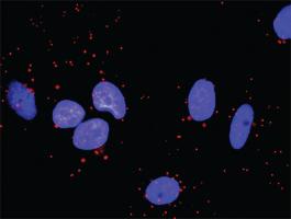 Anti-CDC42 + MAP3K4 Antibody Pair