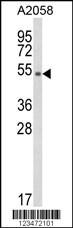 Anti-DAB2 Rabbit Polyclonal Antibody (AP (Alkaline Phosphatase))