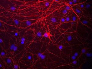 Immunofluorescent analysis of rat neuron/glial cell cultures stained with Anti-NF-M Antibody (red). The NF-M protein is assembled into neurofilaments which are found throughout the axons, dendrites, and perikarya of neurons. The blue is DAPI staining of nuclear DNA.