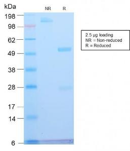 SDS-PAGE analysis of Anti-ATRX Antibody [ATRX/2900R] under non-reduced and reduced conditions; showing intact IgG and intact heavy and light chains, respectively. SDS-PAGE analysis confirms the integrity and purity of the antibody.