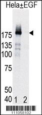 Anti-EGFR Rabbit Polyclonal Antibody