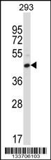 Anti-FCGR2C Rabbit Polyclonal Antibody (AP (Alkaline Phosphatase))