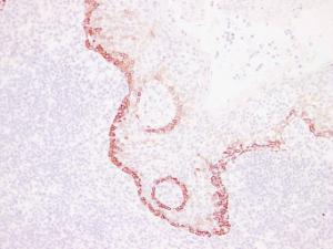 Immunohistochemical analysis of paraffin-embedded human Tonsil using Anti-Cytokeratin 15 Antibody