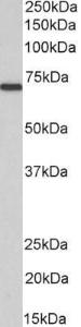 Anti-MTM1 Antibody (A83787) (1 µg/ml) staining of Mouse Skeletal Muscle lysate (35 µg protein in RIPA buffer) Primary incubation was 1 hour Detected by chemiluminescence