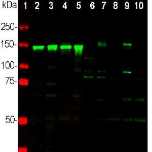 Western blot analysis of different neuronal tissue and cel