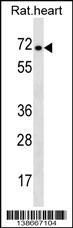 Anti-STRA6 Rabbit Polyclonal Antibody (AP (Alkaline Phosphatase))