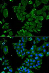 Immunofluorescence analysis of HeLa cells using Anti-Drebrin Antibody (A9845). DAPI was used to stain the cell nuclei (blue)