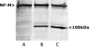 Western blots of homogenates of SH-SY5Y cells, a human neuroblastoma cell line. Lane A shows blotting with Anti-NF-M Antibody which reveals a strong NF-M band at ~150kDa.