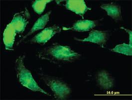 Anti-SSR2 Mouse Monoclonal Antibody [clone: 4C1]