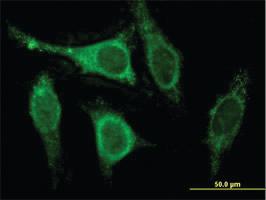 Anti-KCNIP3 Mouse Monoclonal Antibody [clone: 2B3-A1]