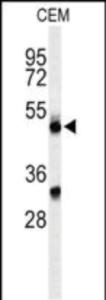 Anti-CFP Rabbit Polyclonal Antibody (Biotin)