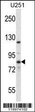 Anti-EIF2B5 Rabbit Polyclonal Antibody