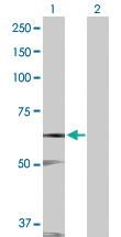 Anti-STK17A Rabbit Polyclonal Antibody