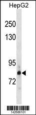 Anti-HDGR2 Rabbit Polyclonal Antibody (HRP (Horseradish Peroxidase))