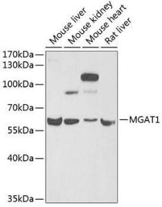 Western blot analysis of extracts of various cell lines, using Anti-MGAT1 Antibody (A9848) at 1:1,000 dilution