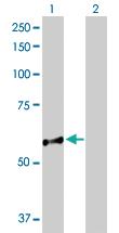 Anti-NUP98 Rabbit Polyclonal Antibody