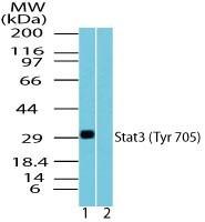 Anti-STAT3 Rabbit Polyclonal Antibody